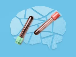 Alzheimer’s blood test